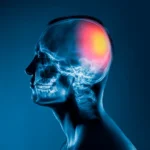 Centro de Neurorrehabilitación en Madrid